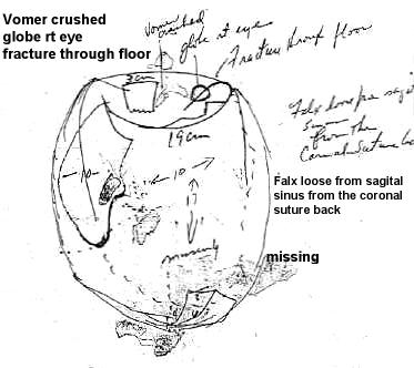 teb2717 JFKBoswellDiagram