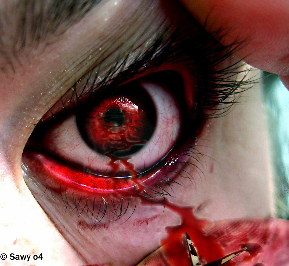 Bilder-Thread Blood Shot Eye by eye freaks