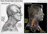 neck transit lateral 02