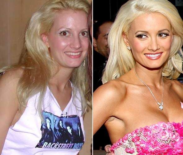holly madison before after