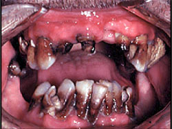 methmouth image 02