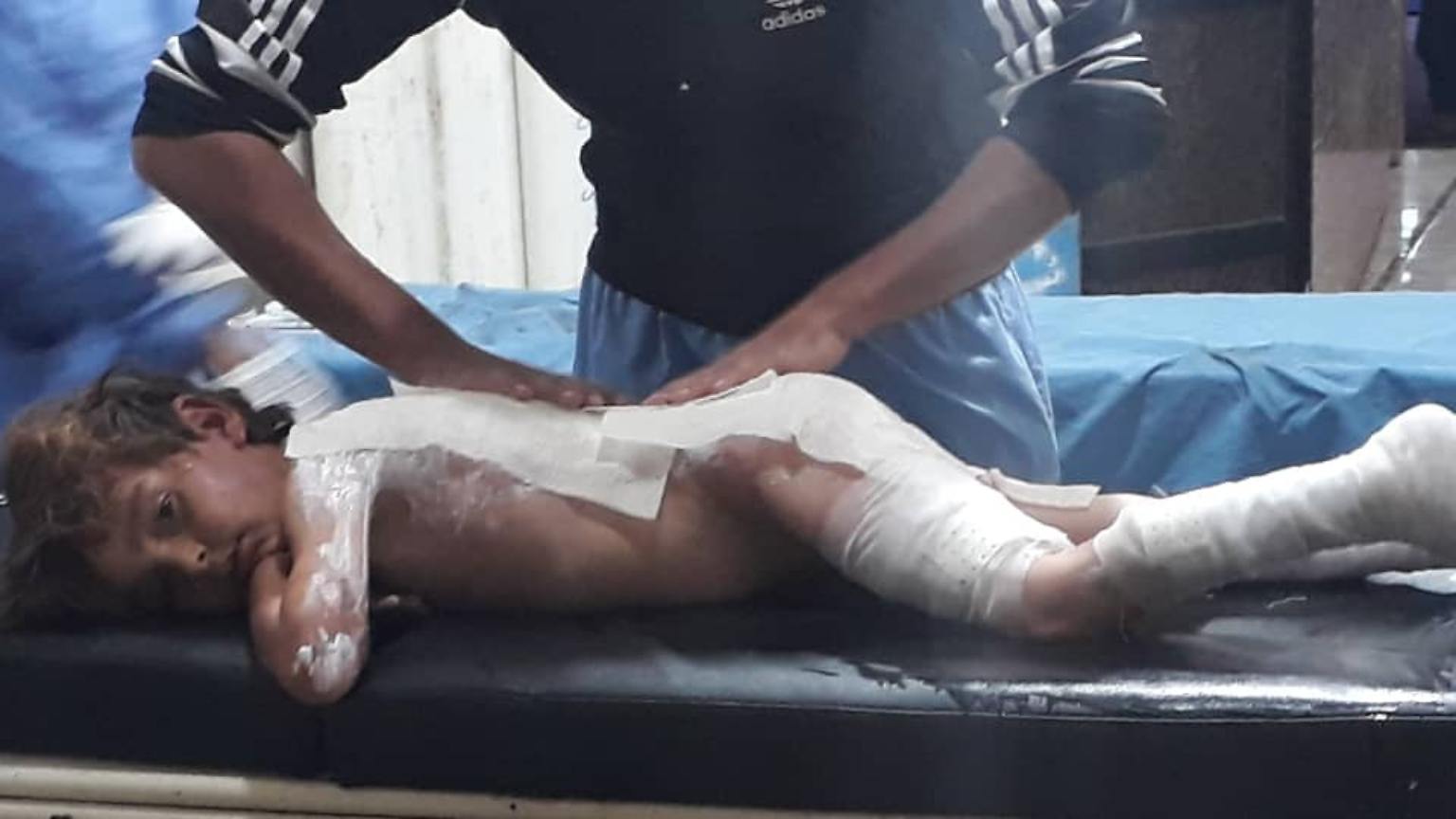 Tal-Tamr-Krankenhaus-verletztes-KInd-aus
