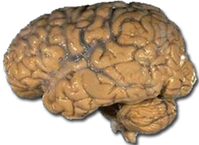 220px-Human brain NIH