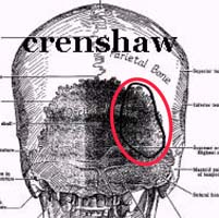 jfk crenshaw woundB200x201