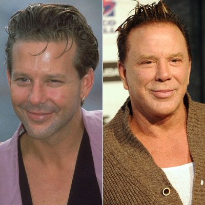 mickey-rourke-vorher-nachher-400x400-986