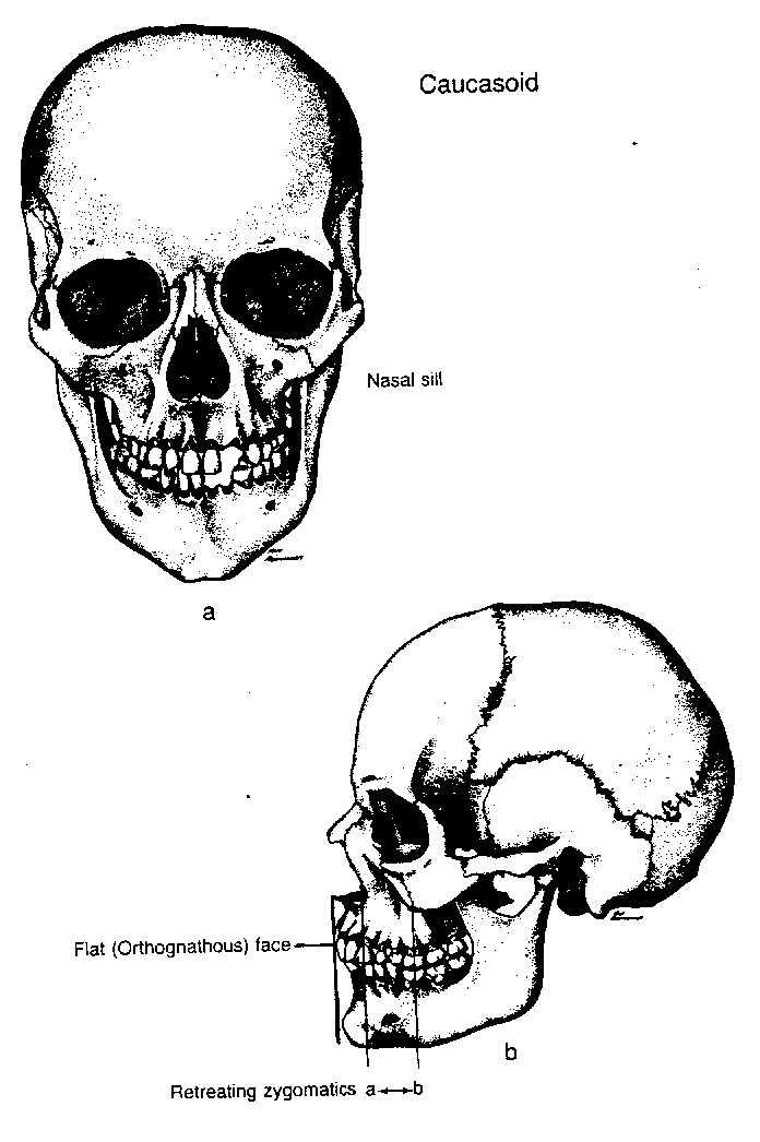 Skullcauc