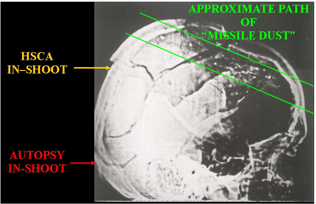 tc7cdd5 t66d2ef AnnXray2