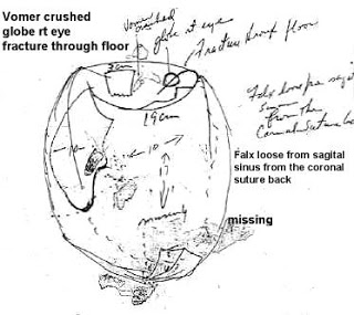 JFKBoswellDiagram