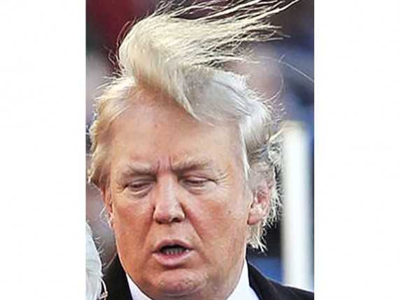 donald-trump-hair-photos-mystery-transpl