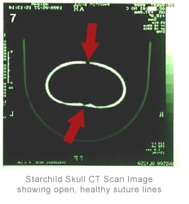 hydro-ct