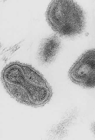326px-Smallpox virus virions TEM PHIL 18