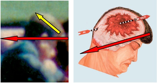 fig 5