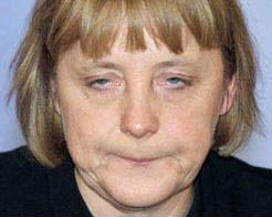Bilder-Thread gesichtslaehmung 1