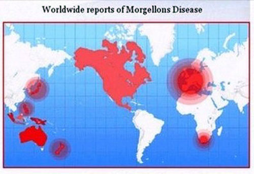 chemtrail-morgellons