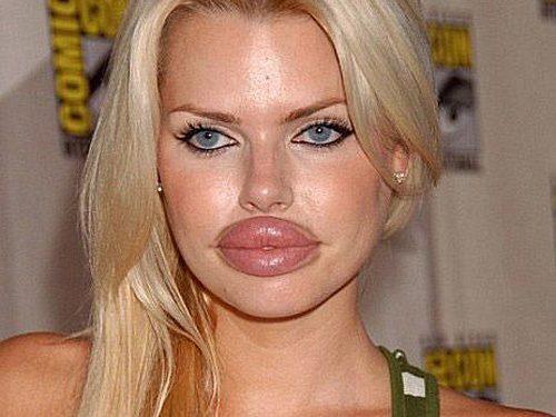 a plastic surgery fail 3