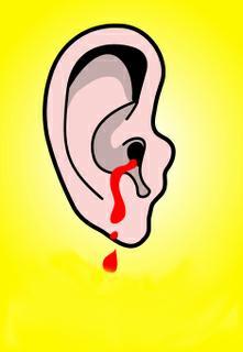 bleeding-ears