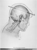 jfk20Z31220profile20w20bullet20channels2