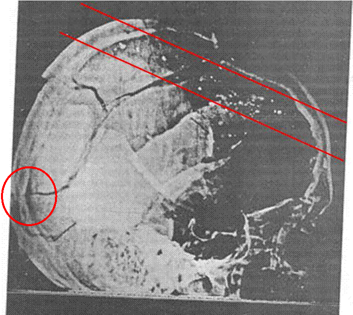 td27f1baafef6 Xrayentrance zps1d9922ec