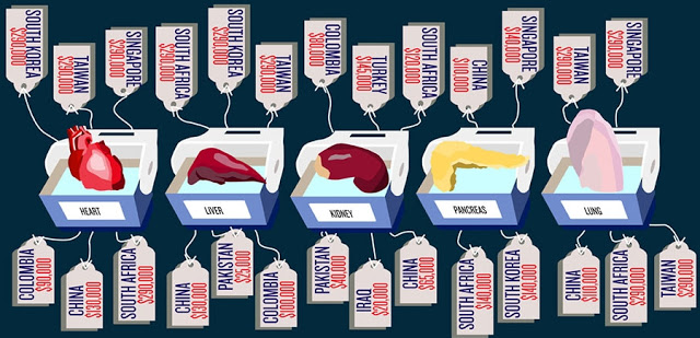 organharvesting costchart