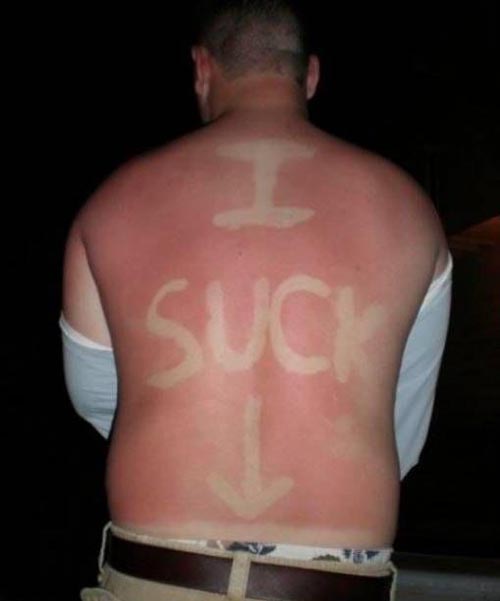Bilder-Thread I SUCK Sunburn