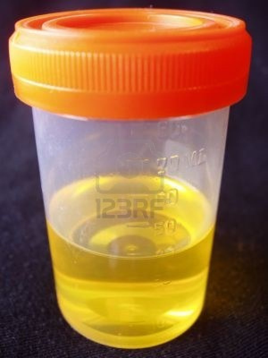 385778-urinprobe-in-flakons