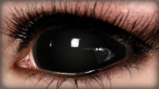 black sclera