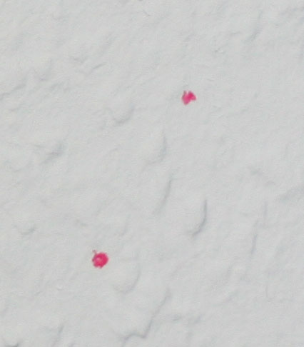 rote-flecken-close