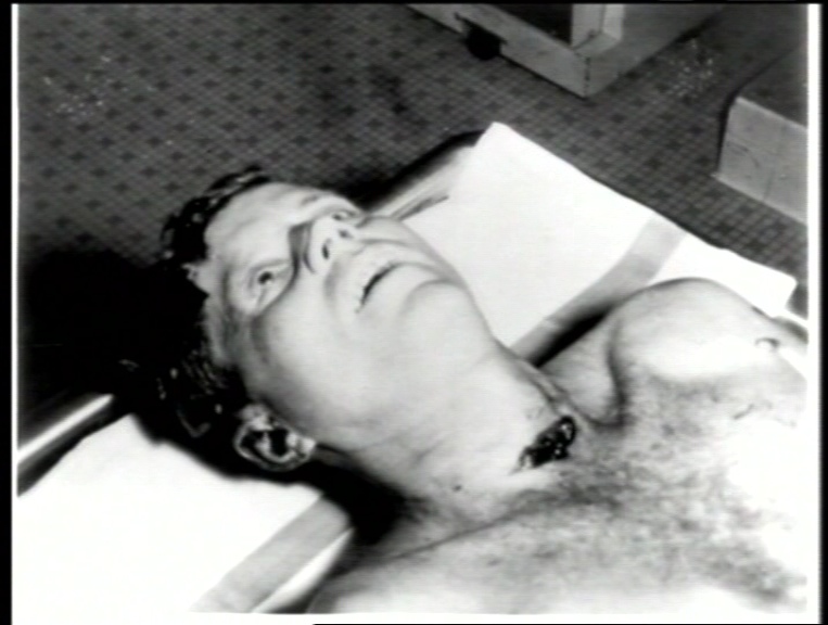 t023c1a gg43781262513309jfk neck wound.j