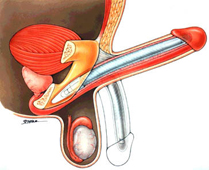 implantat-biegsam