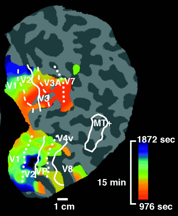 HAD01Fig4E