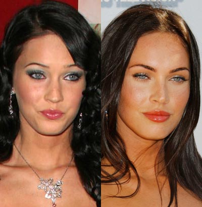 megan-fox-before-after-surgery-1-7