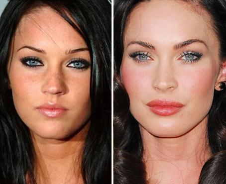 megan fox before-and-after-nose-job
