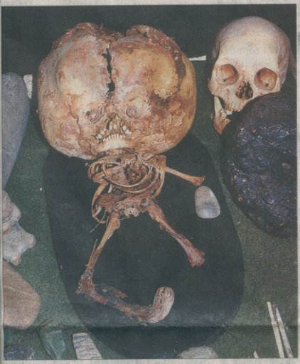 brazil-star-child-skull-skeleton