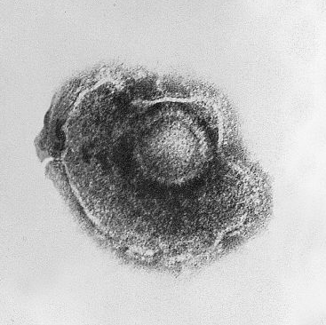 virus-wikipedia-tim