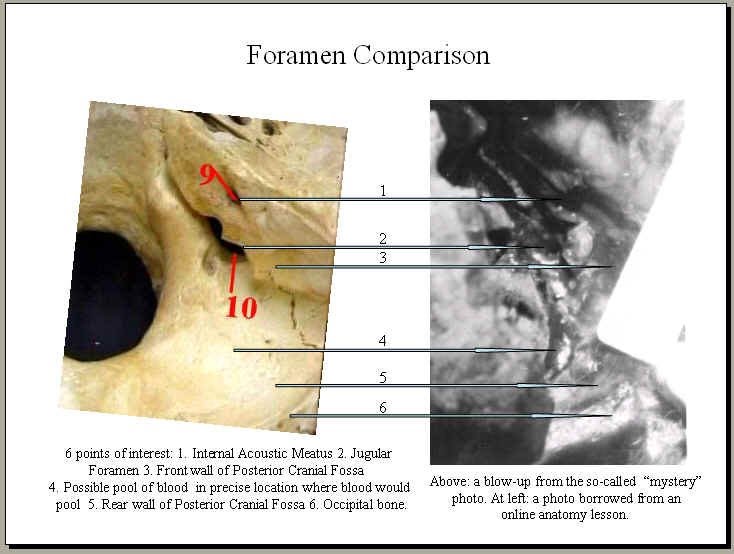 foramen-full