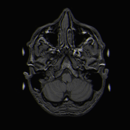 Brain MRI T1 movie