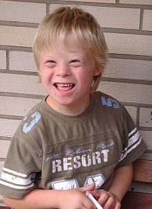 220px-Boy with Down Syndrome