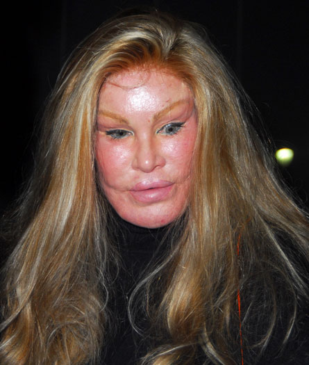 jocelyn wildenstein 5 wenn11