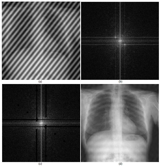 Use of Fourier transformation chest radi