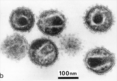 HIV EM