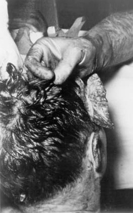 JFK-Autopsy-Photo-BOH