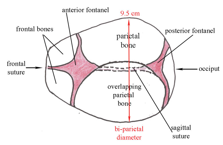 ldc session1 fig8a