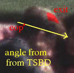 eop-vs-tsbd