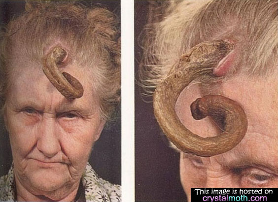 shocking picture woman with horn growing