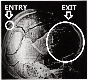 JFK-Xray