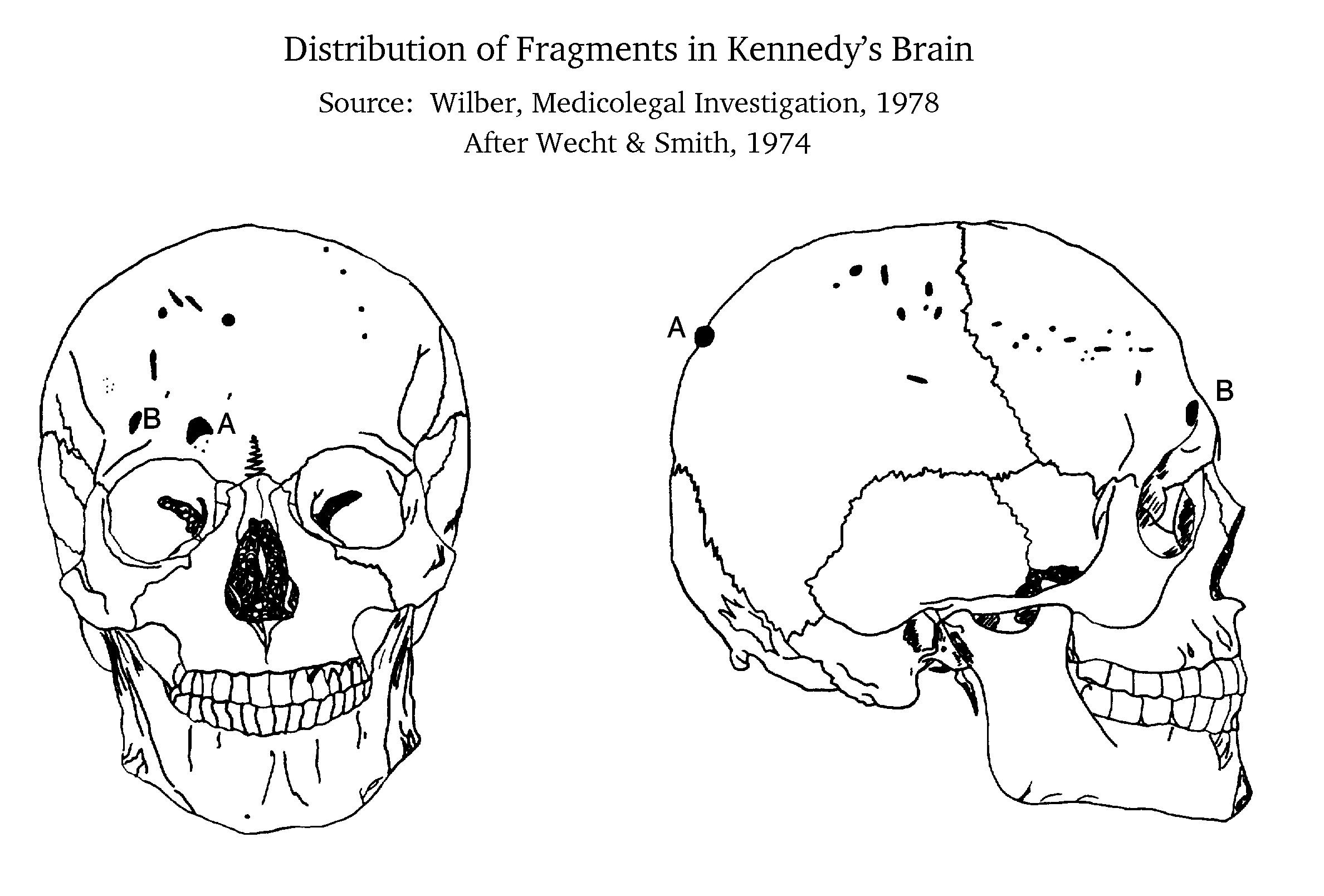 t2375709 wound1