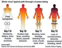 912be9 ebola-symptoms