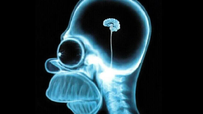 homer brain scan.jpgitok1YviyP61