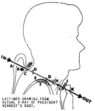 Lattimer drawing