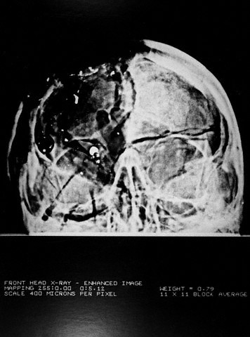 tb46e08 apxray